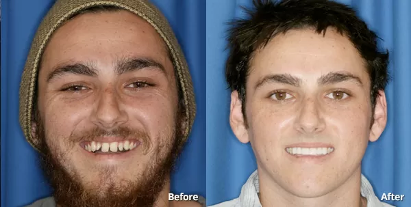 Results of restorative dentistry procedure in Phoenix AZ