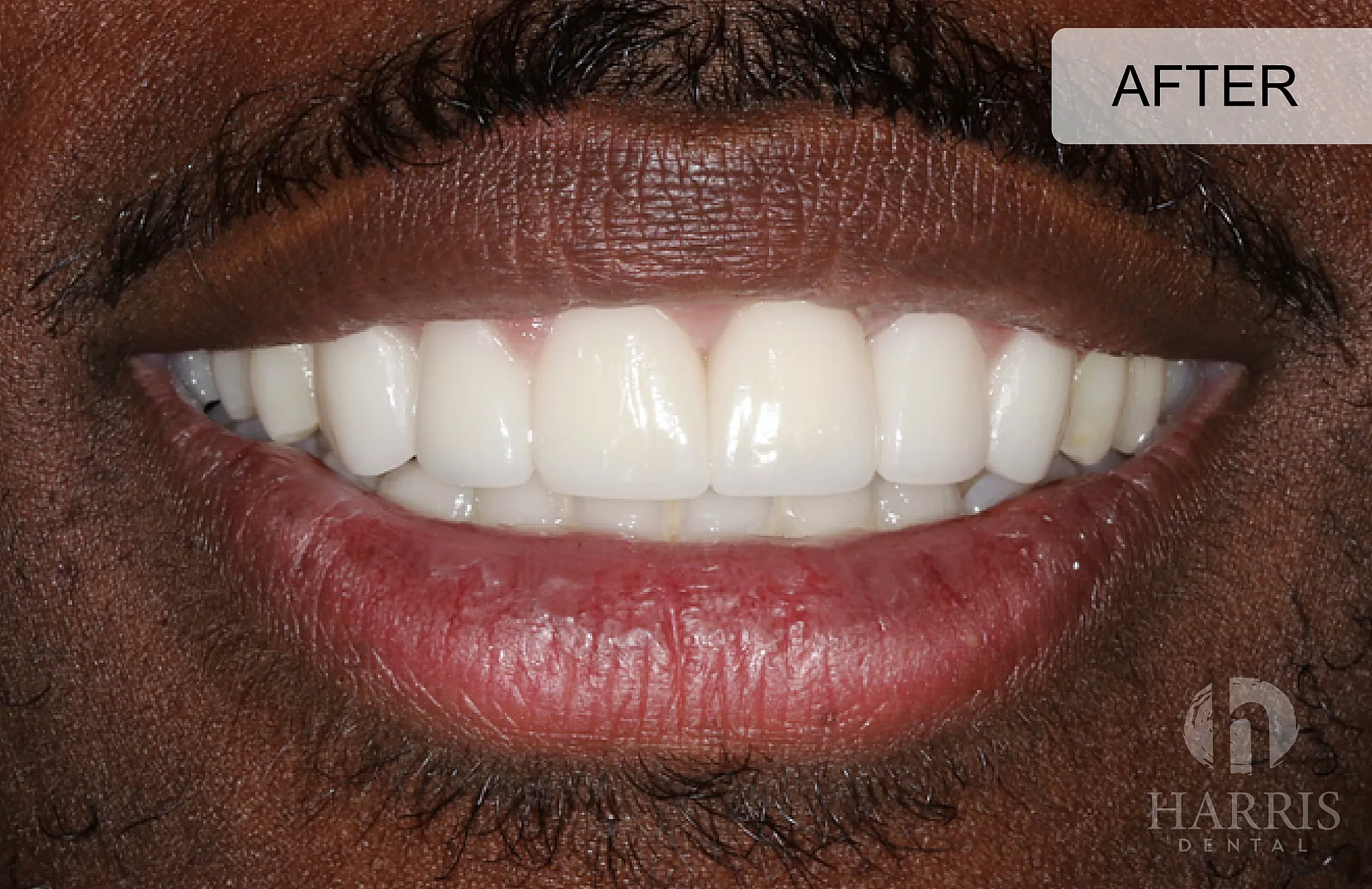 drbrianharris after