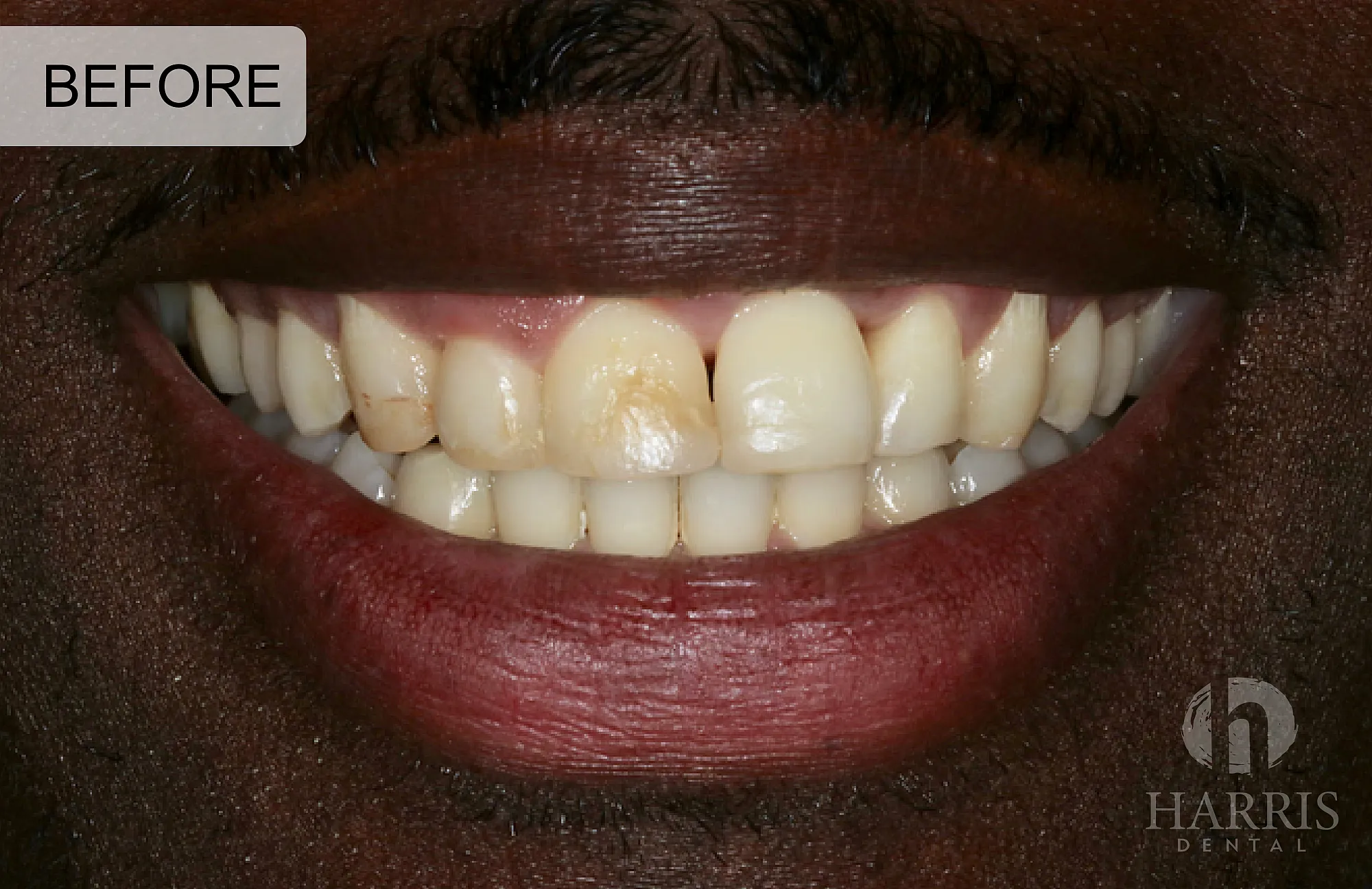 drbrianharris before