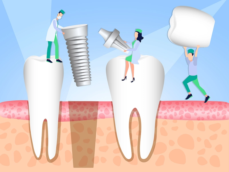 dentist-implant-timeline