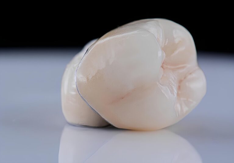 up close porcelain dental crown in Phoenix